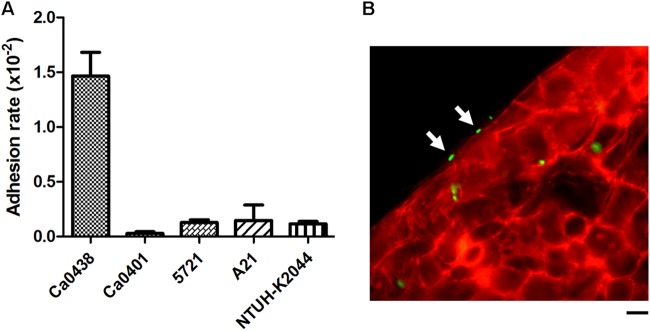 FIG 1