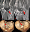 Fig. 5