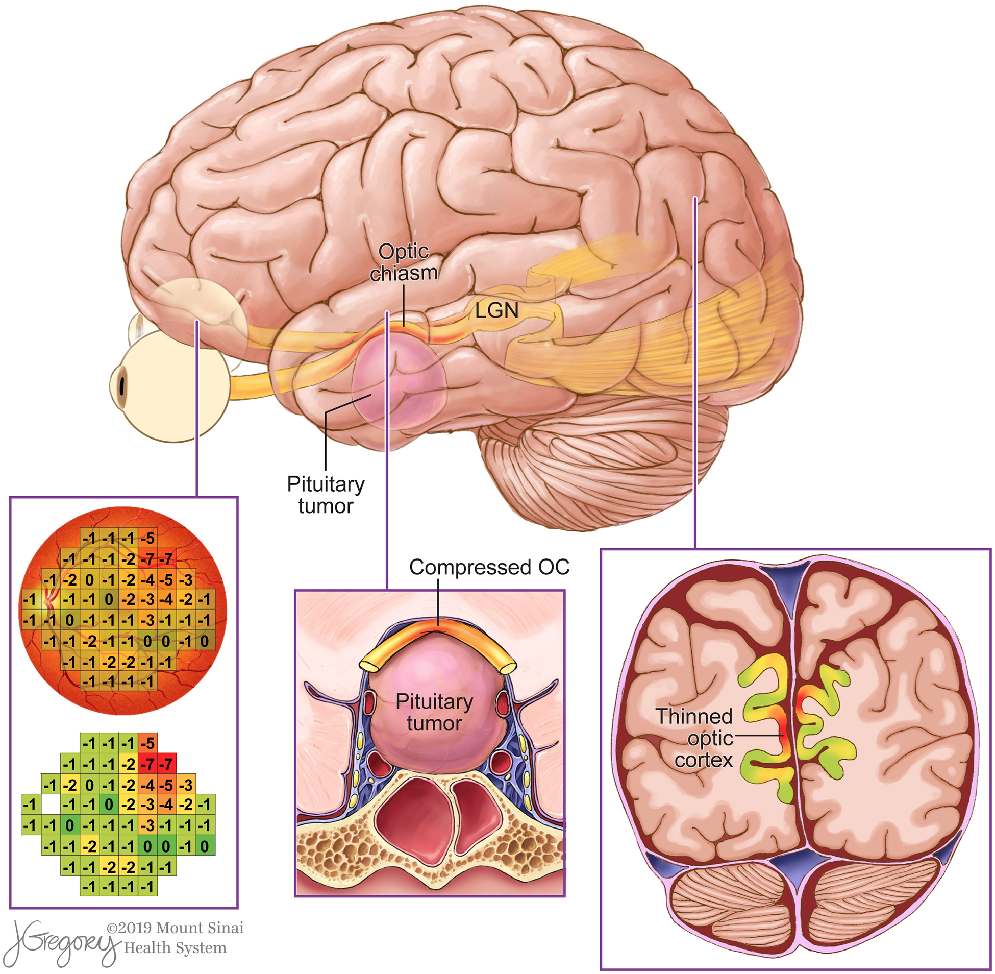 Figure 6.