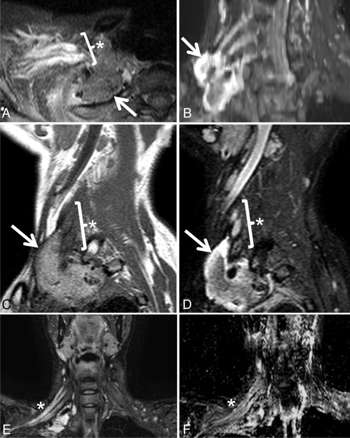 Fig 8.