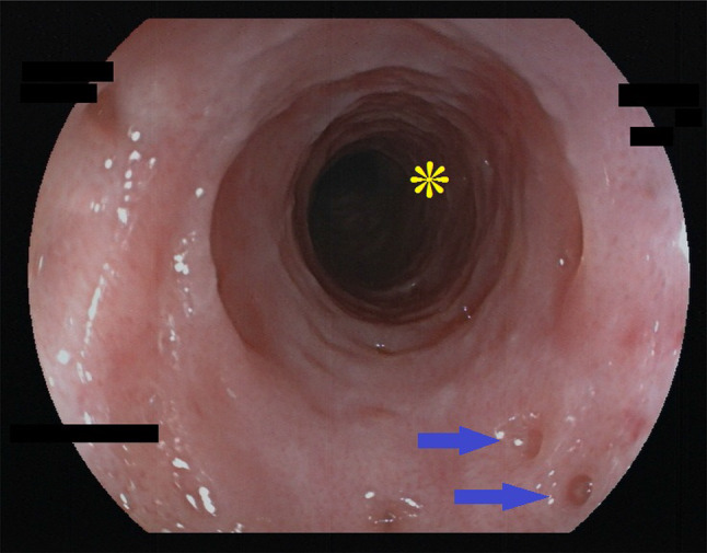 Fig. 5