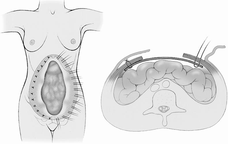 graphic file with name 14FF2.jpg