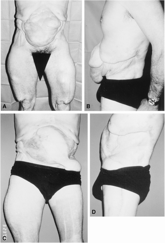 graphic file with name 14FF6.jpg