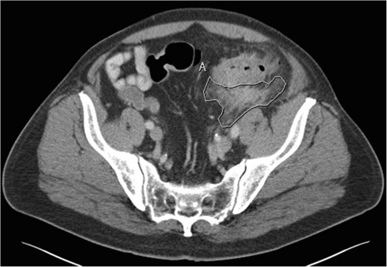 Fig. 1