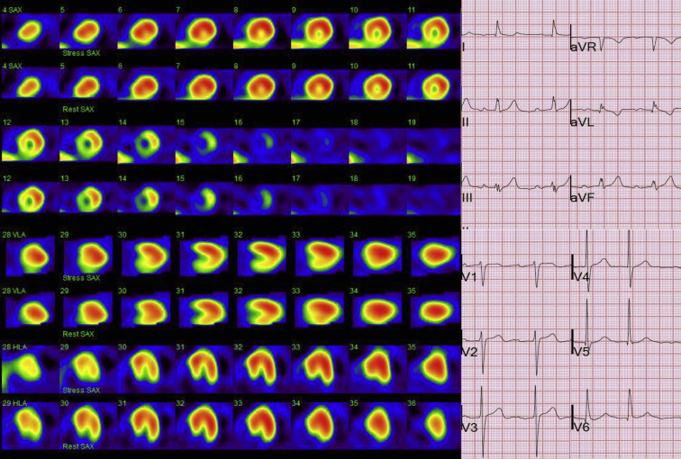 Fig. 1