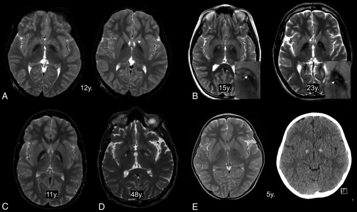 Fig 3.