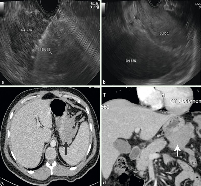 Fig. 1