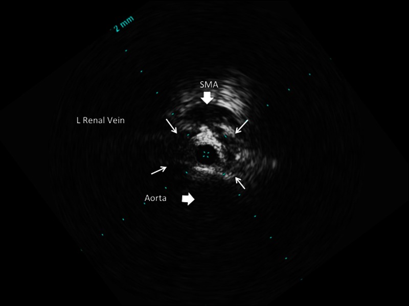 Figure 3