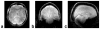 FIG. 9