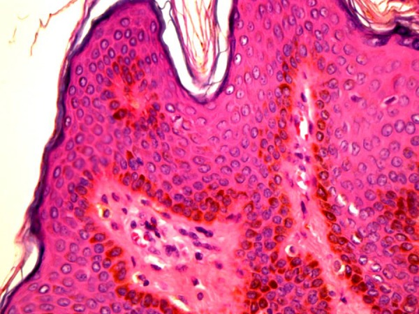 Figure 3