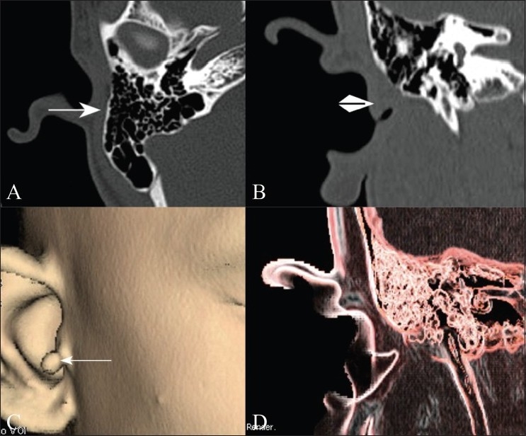 Figure 2 (A-D)