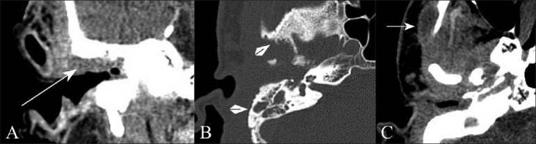 Figure 3 (A-C)
