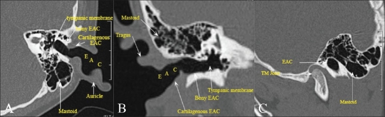 Figure 1 (A-C)
