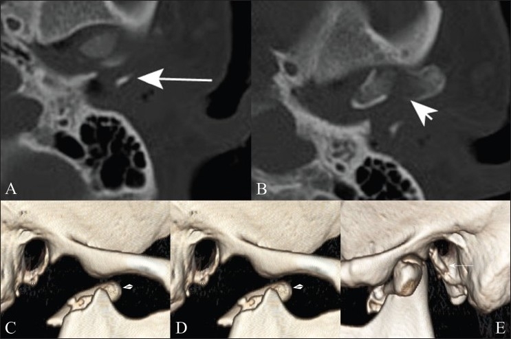 Figure 5 (A-E)