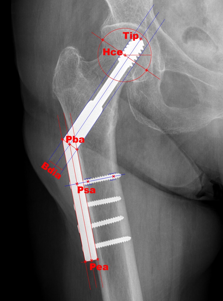 Fig. 1