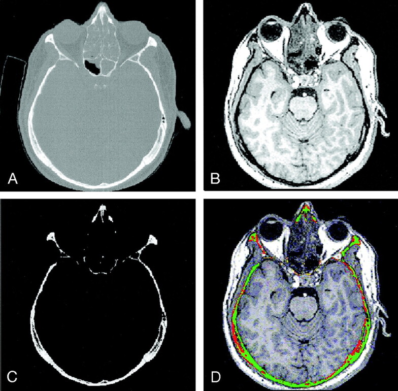 Fig 1.