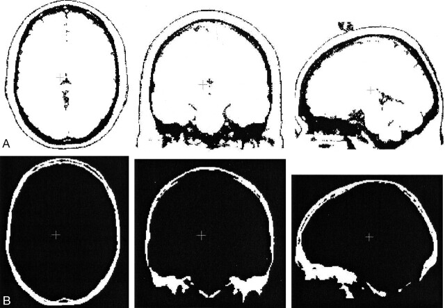 Fig 4.