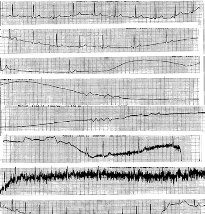 Figure 5: