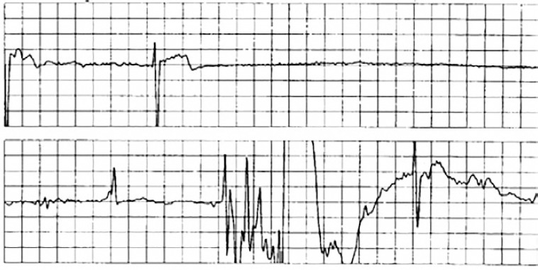 Figure 8: