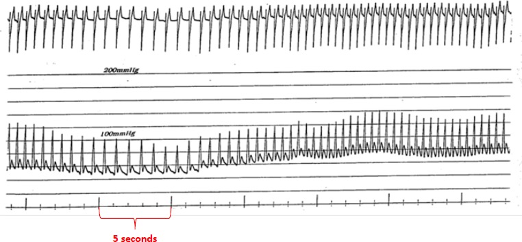 Figure 1: