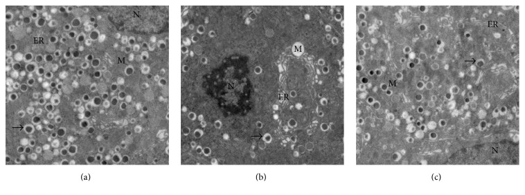 Figure 11