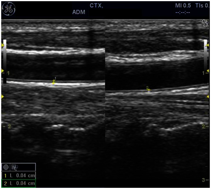 Figure 4