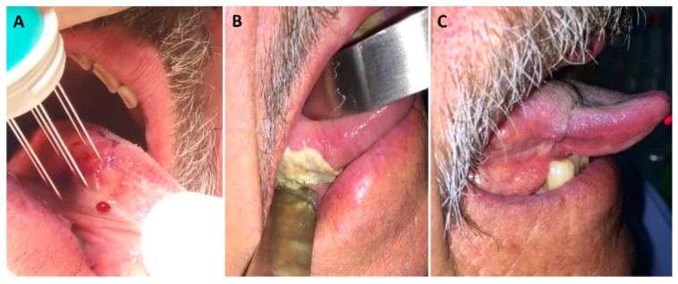 Figure 2