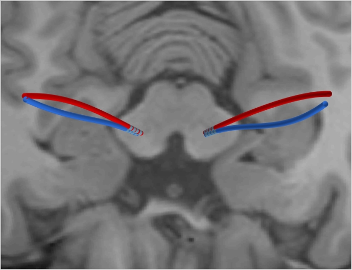 Fig. 10