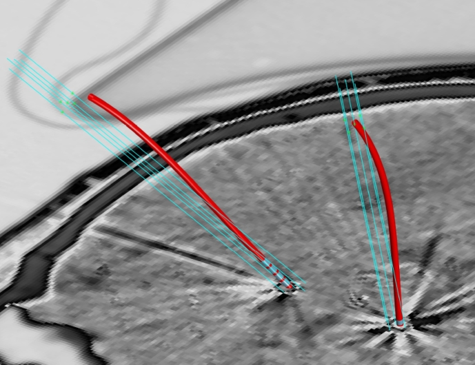 Fig. 11