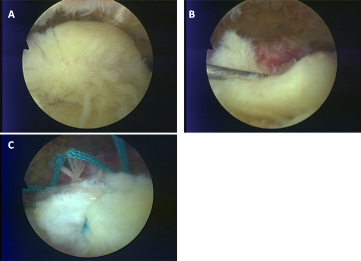 Fig. 1