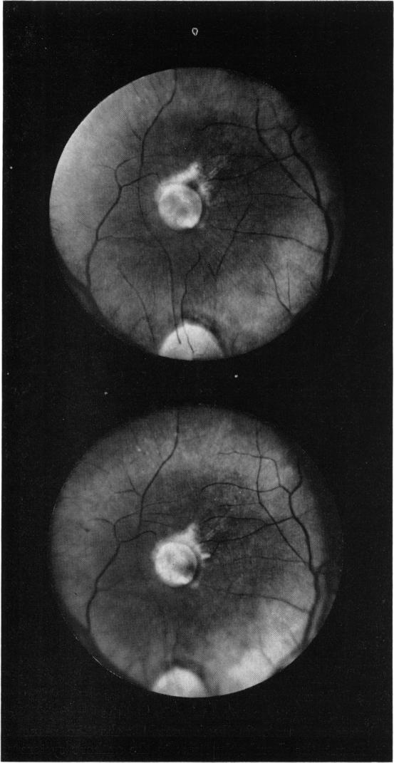 FIGURE 13.