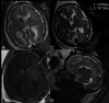 FIG 3.