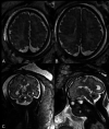 FIG 4.