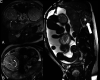 FIG 5.