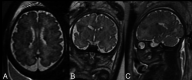 FIG 2.
