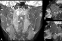 Fig 1.