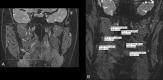 Fig 3.