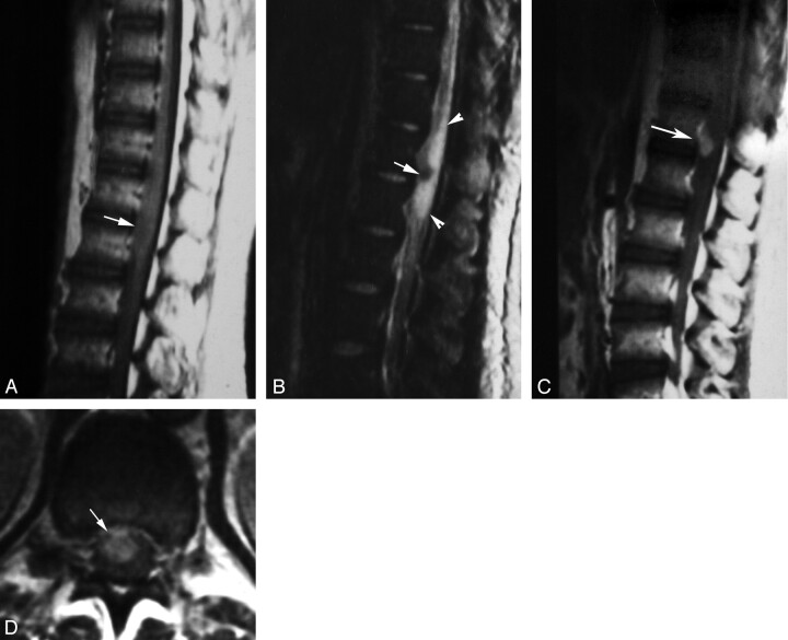 Fig 3.