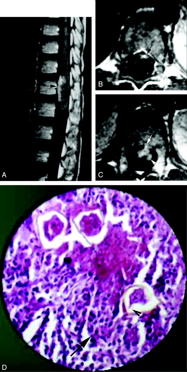 Fig 4.