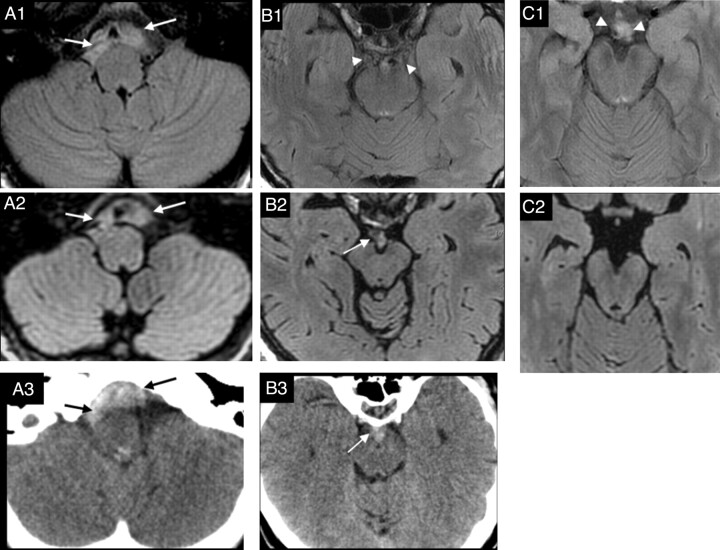 Fig 5.