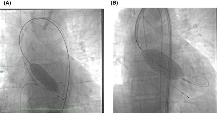 FIGURE 3