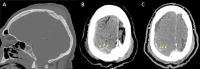 Fig. 17