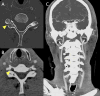 Fig. 5