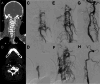 Fig. 13