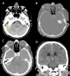 Fig. 14