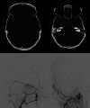 Fig. 10