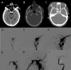 Fig. 11