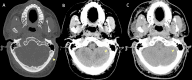 Fig. 16