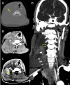 Fig. 7