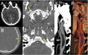 Fig. 3